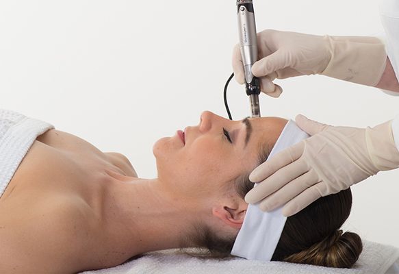 Book a Dermapen Microneedling session at Facebeautique